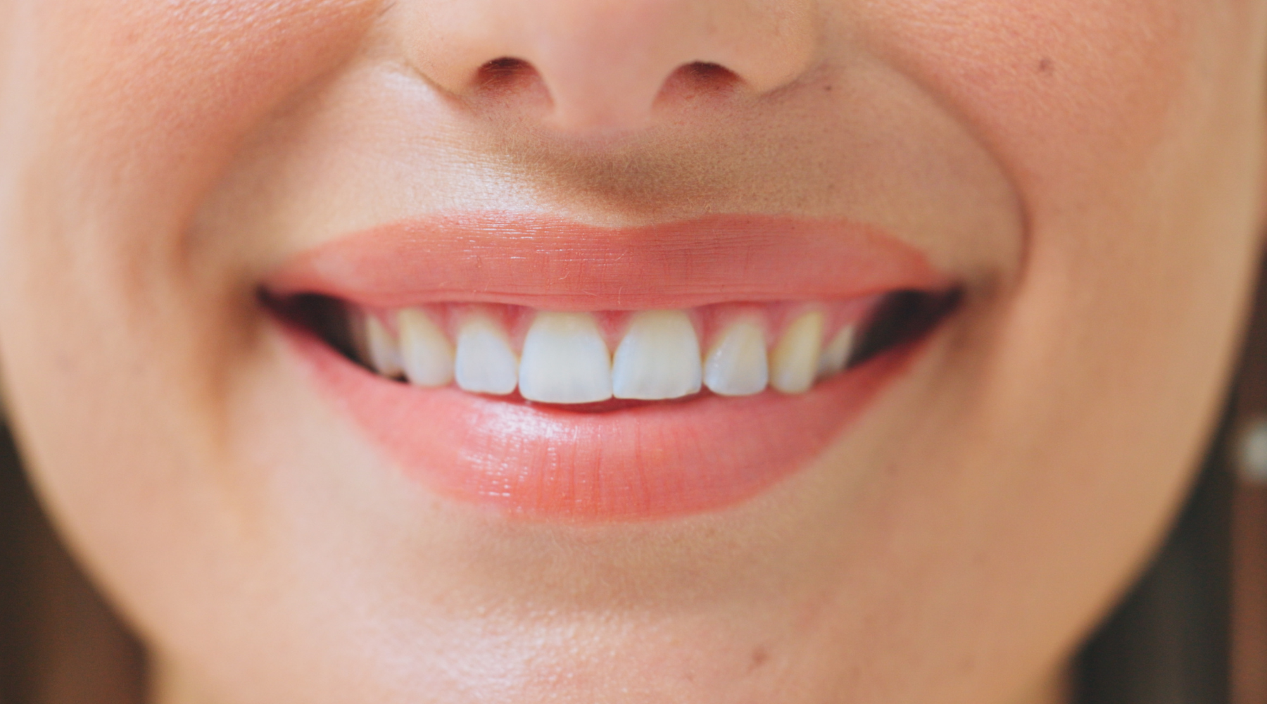 How To Whiten Your Teeth Naturally and Tips to Keep Your Smile Bright