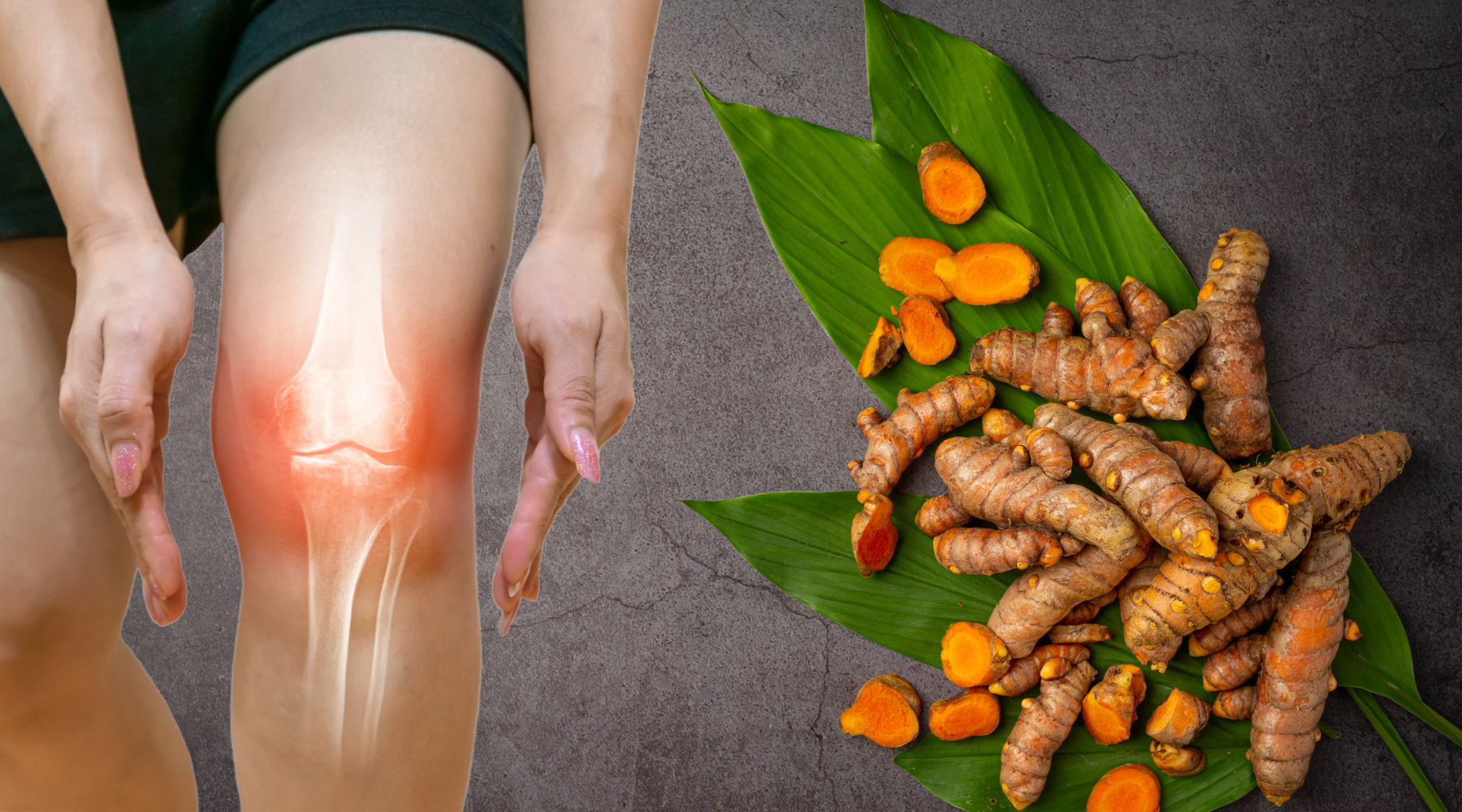 Inflammation and Joint Mobility: The Power of Turmeric, Curcuminoids, and Other Natural Supplements